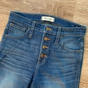 Madewell 10” Rise Button-Front Skinny jeans